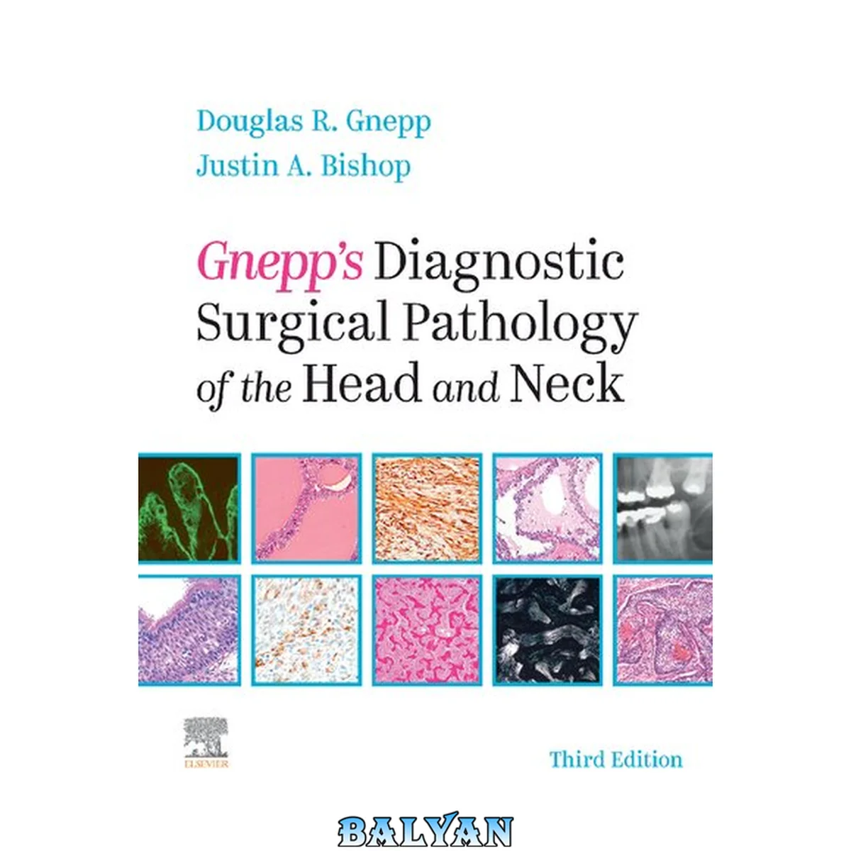 جلد کتاب Gnepp's Diagnostic Surgical Pathology of the Head and Neck: Gnepp's Diagnostic Surgical Pathology of the Head and Neck E-Book