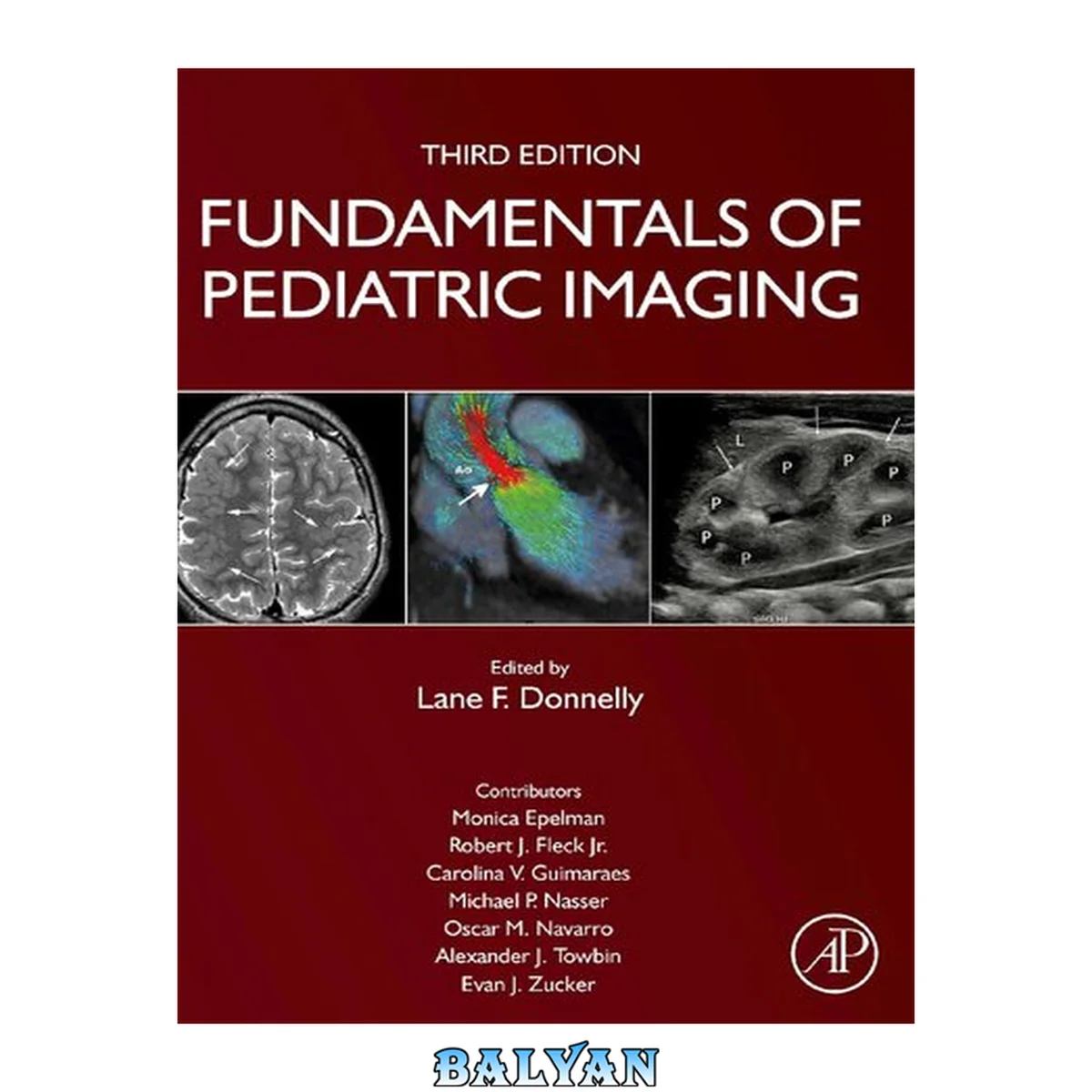 جلد کتاب Fundamentals of Pediatric Imaging, 3e