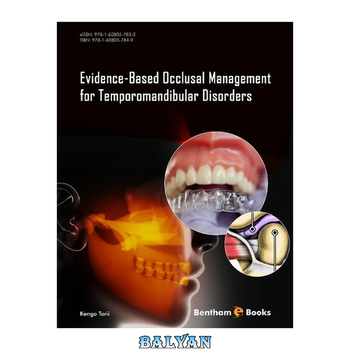 جلد کتاب Evidence-Based Occlusal Management for Temporomandibular Disorders