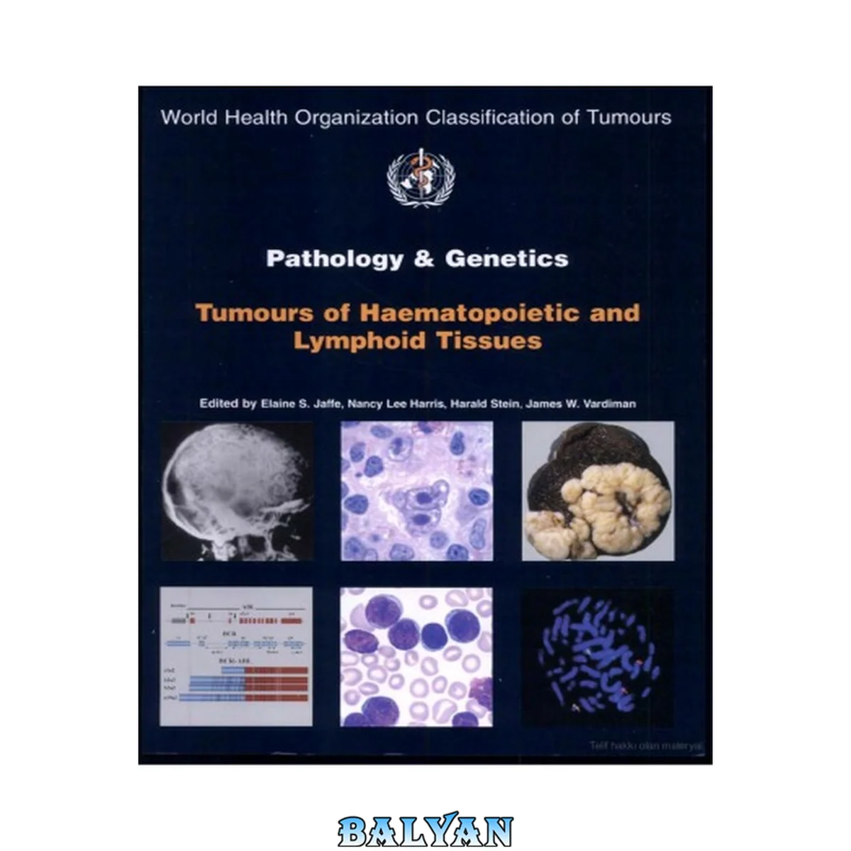 جلد کتاب Pathology and Genetics: Tumours of Haematopoietic and Lymphoid Tissues (World Health Organization Classification of Tumours).