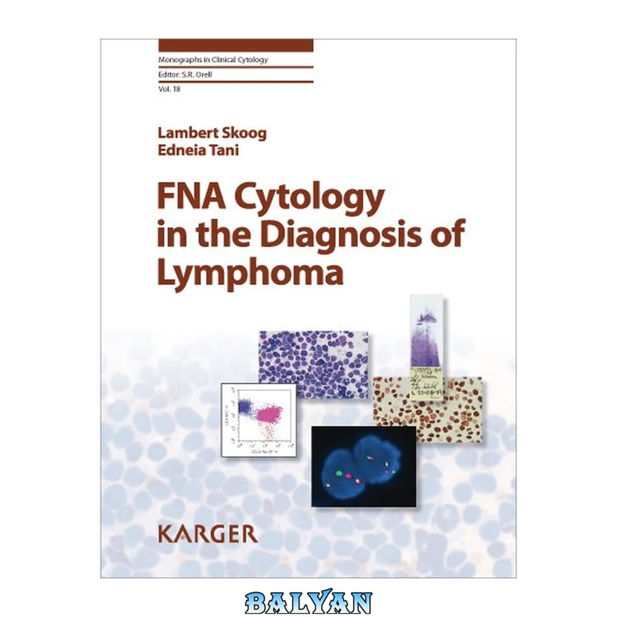 جلد کتاب FNA Cytology in the Diagnosis of Lymphoma (Monographs in Clinical Cytology Vol 18)