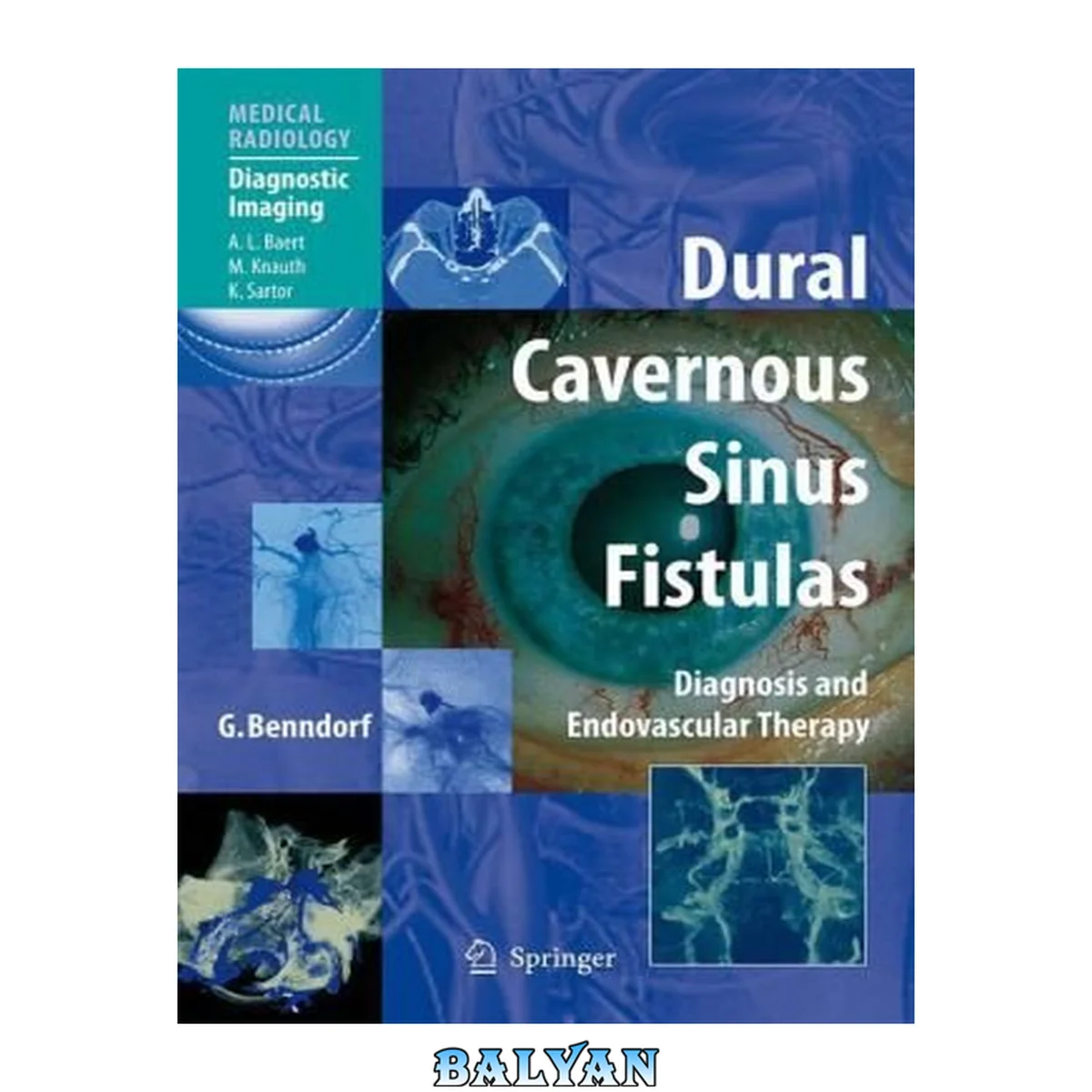 جلد کتاب Dural Cavernous Sinus Fistulas: Diagnosis and Endovascular Therapy (Medical Radiology   Diagnostic Imaging)