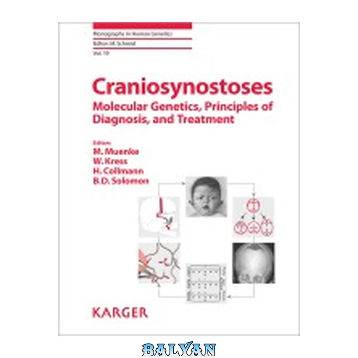 جلد کتاب Craniosynostoses: Molecular Genetics, Principles of Diagnosis, and Treatment (Monographs in Human Genetics, Vol. 19)