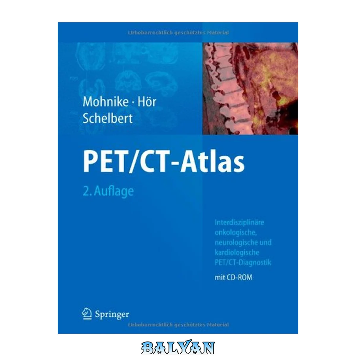 جلد کتاب PET CT-Atlas, 2. Auflage: Interdisziplinäre onkologische, neurologische und kardiologische PET CT-Diagnostik