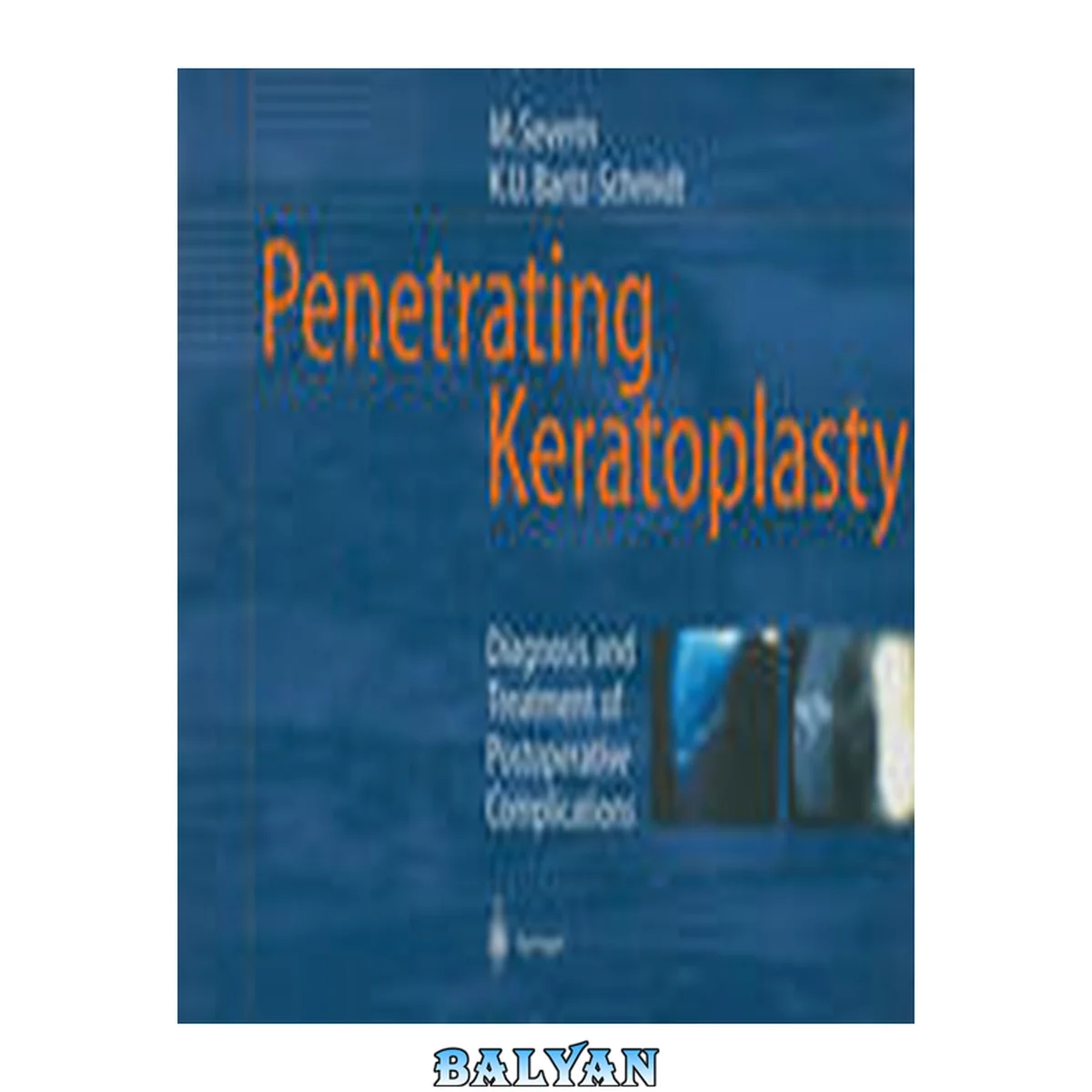 جلد کتاب Penetrating Keratoplasty : Diagnosis and Treatment of Postoperative Complications