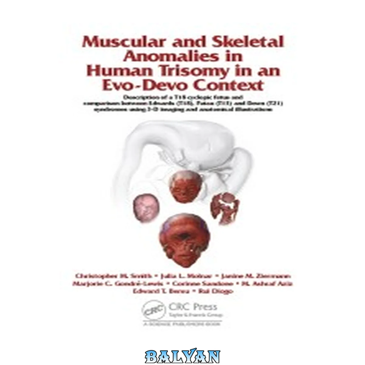 جلد کتاب Muscular and skeletal anomalies in human trisomy in an evo-devo context : description of a T18 cyclopic fetus and comparison between Edwards (T18), Patau (T13) and Down (T21) syndromes using 3-D imaging and anatomical illustrations