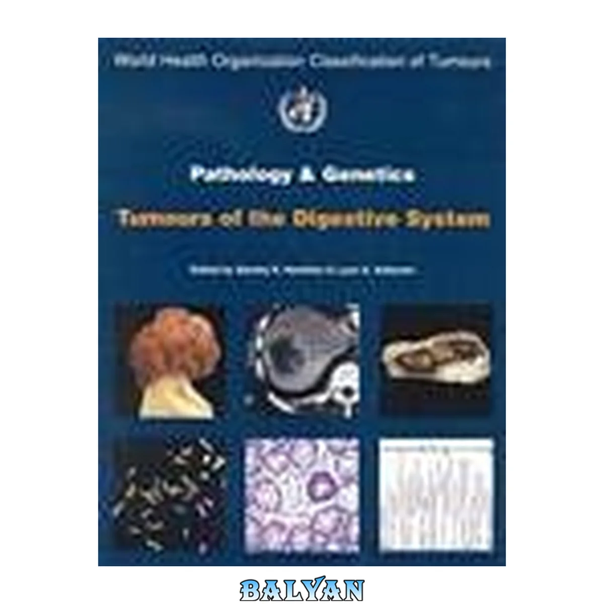 جلد کتاب Pathology and Genetics of Tumours of the Digestive System   (World Health Organization Classification of Tumours)