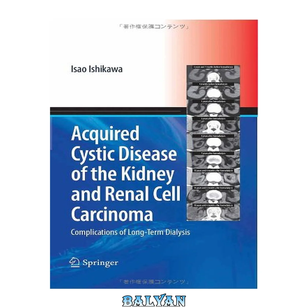 جلد کتاب Acquired cystic disease of the kidney and renal cell carcinoma : complications of long-term dialysis