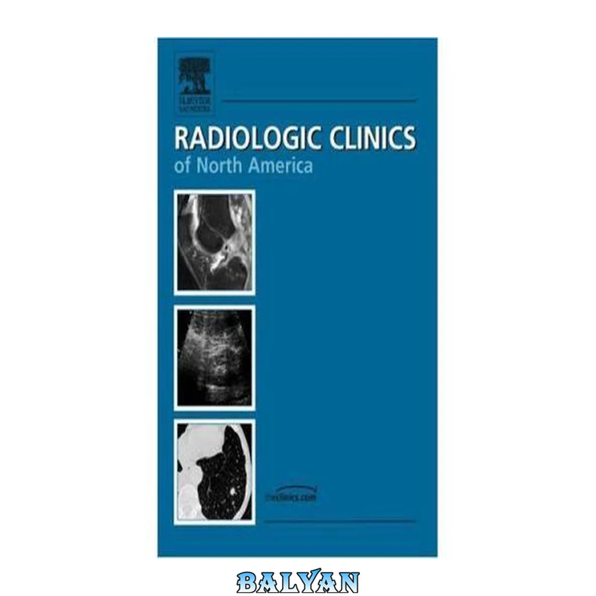 جلد کتاب Radiologic Clinics Of North America. Diagnostic Challenges in Musculoskeletal Radiology Vol 43  Issues 4