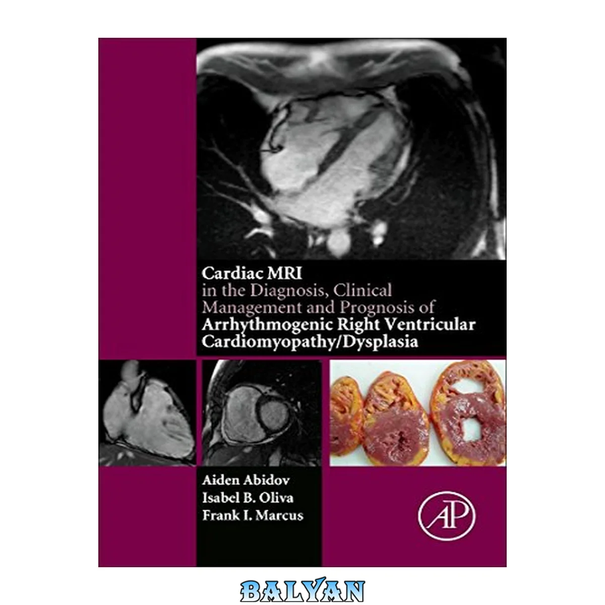 جلد کتاب تصویربرداری MRI قلب در تشخیص، مدیریت بالینی و پیش‌آگهی کاردیومیوپاتی/دیسپلازی بطنی راست آرریتموژنیک