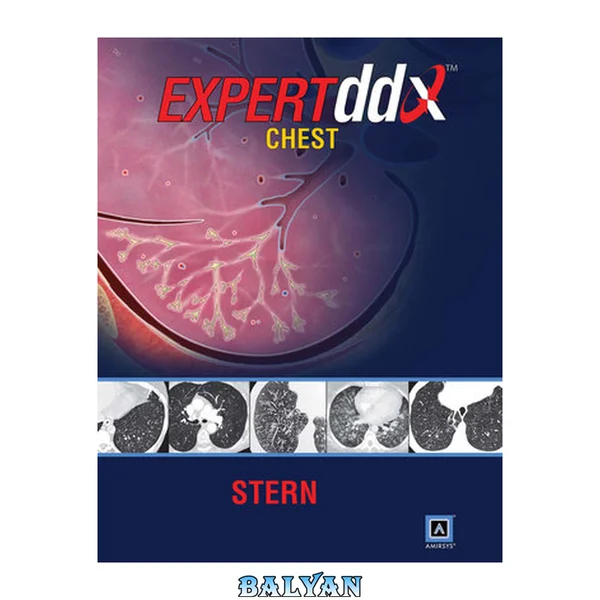 EXPERTddx: قفسه سینه