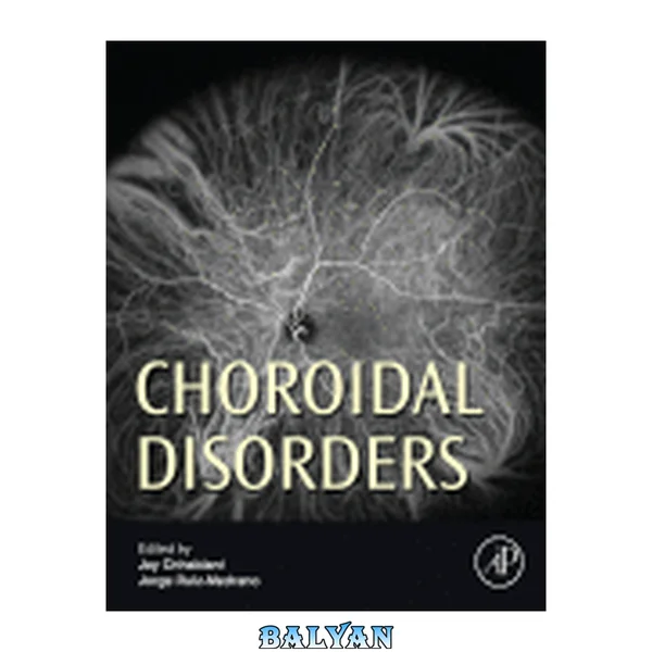 Choroidal Disorders