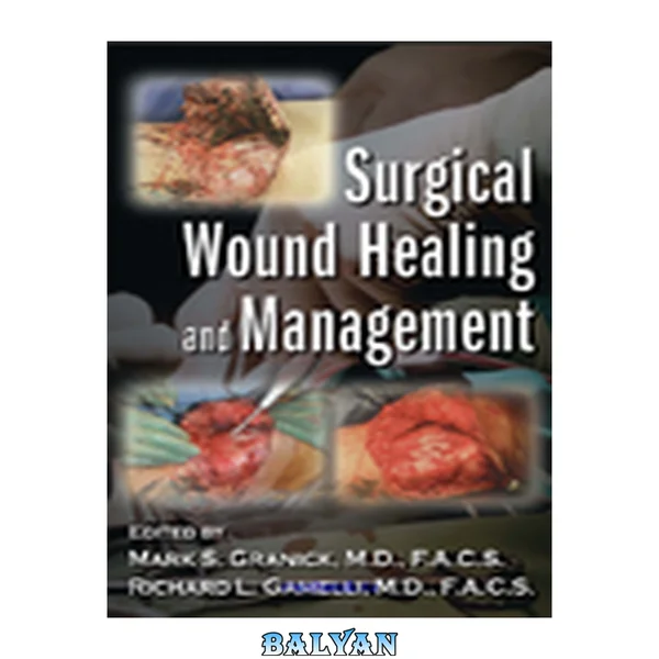 Surgical Wound Healing and Management