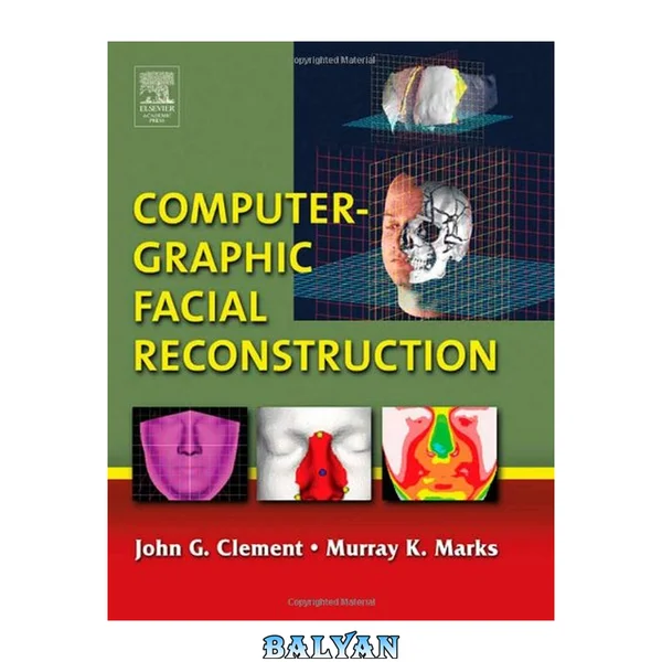 Computer-graphic facial reconstruction
