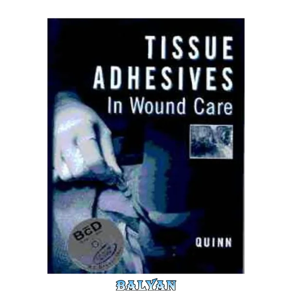 Tissue adhesives in wound care
