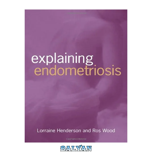 Explaining Endometriosis