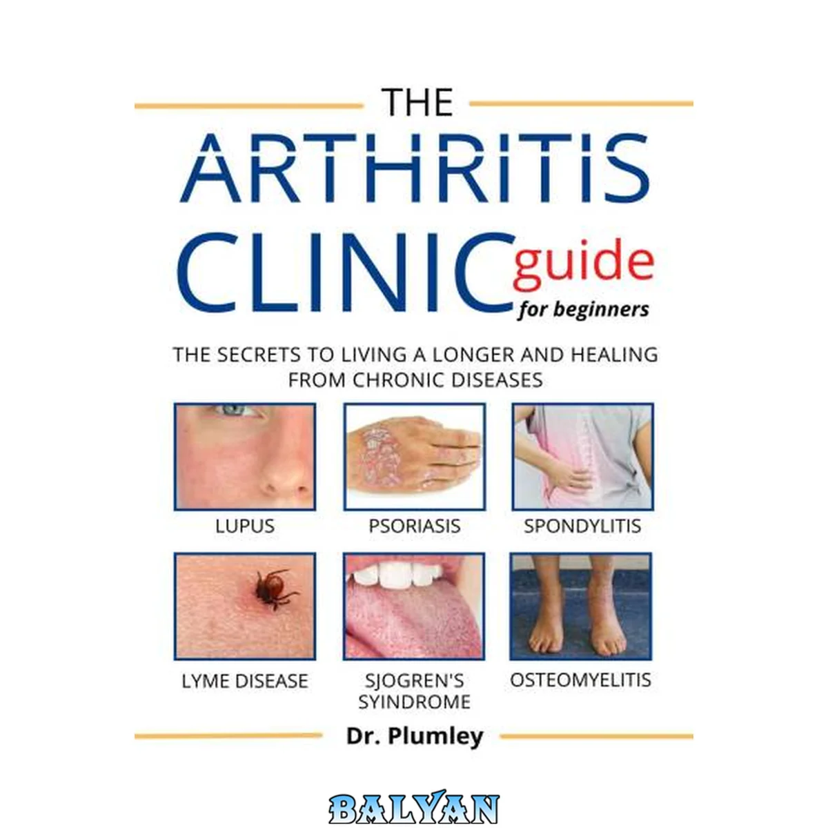 جلد کتاب The Arthritis Clinic Guide for Beginners: The secret to living a longer and healing from chronic disease, such as: lupus, Psoriasis, Spondylitis, Lyme ... Sjogren's syndrome, osteoarthritis, etc.