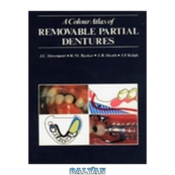 A Color Atlas of Removable Partial Dentures