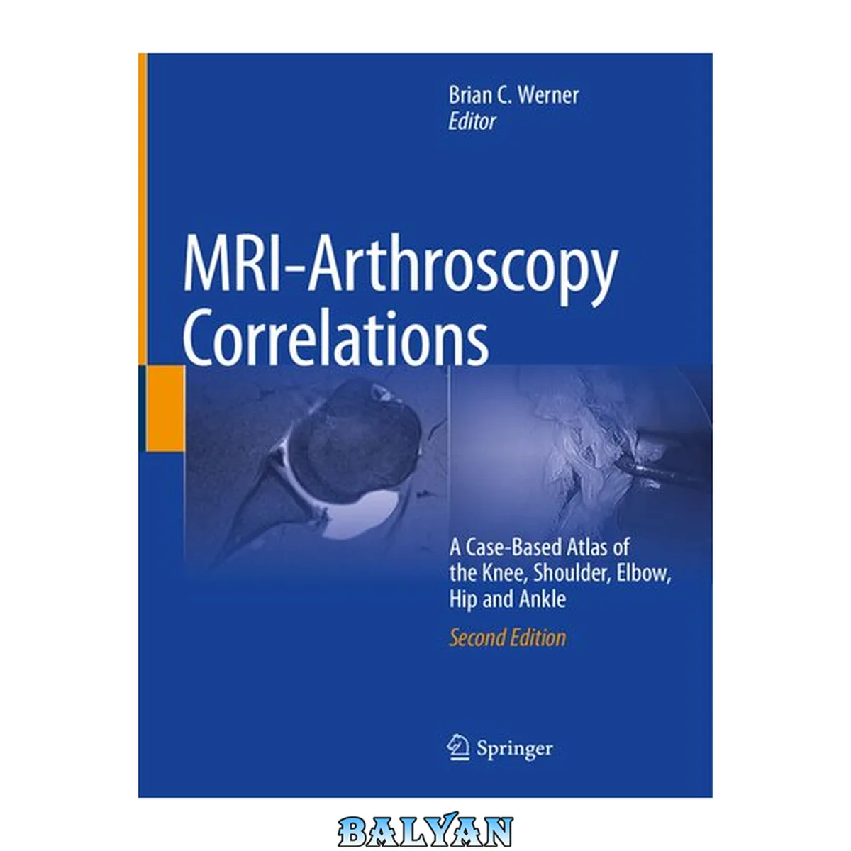 جلد کتاب MRI-Arthroscopy Correlations : A Case-Based Atlas of the Knee, Shoulder, Elbow, Hip and Ankle