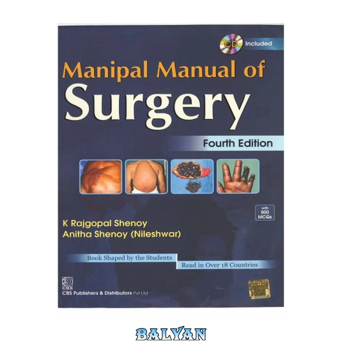 جلد کتاب Manipal Manual of Surgery