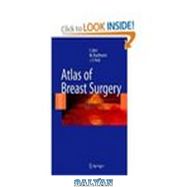 Atlas of Breast Surgery