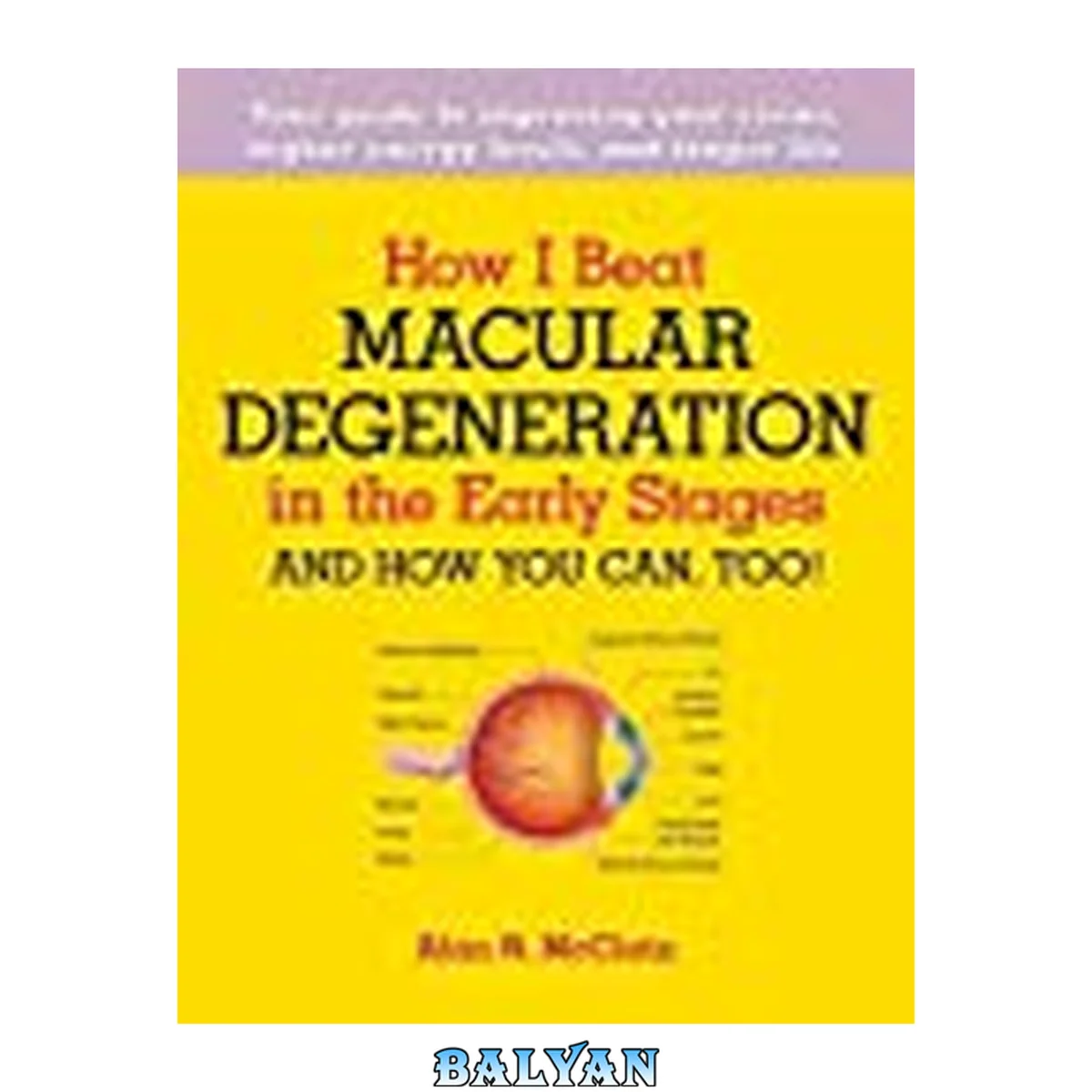 جلد کتاب How I Beat Macular Degeneration in the Early Stages and How You Can, Too!: Your guide to improving your vision, higher energy levels, and longer life