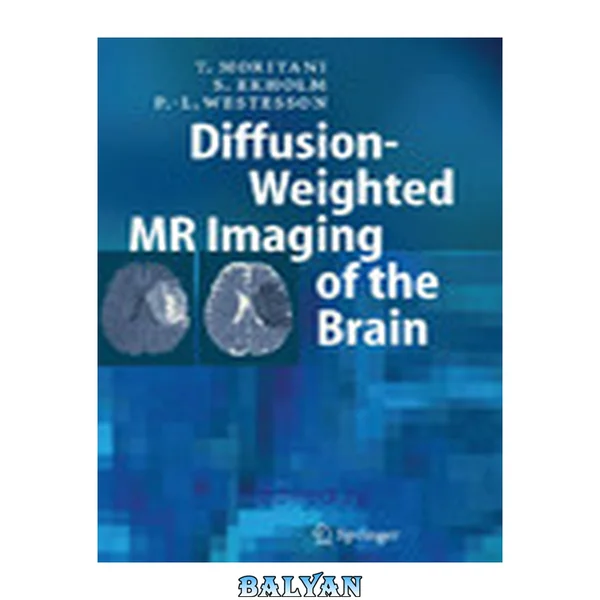 Diffusion-Weighted MR Imaging of the Brain