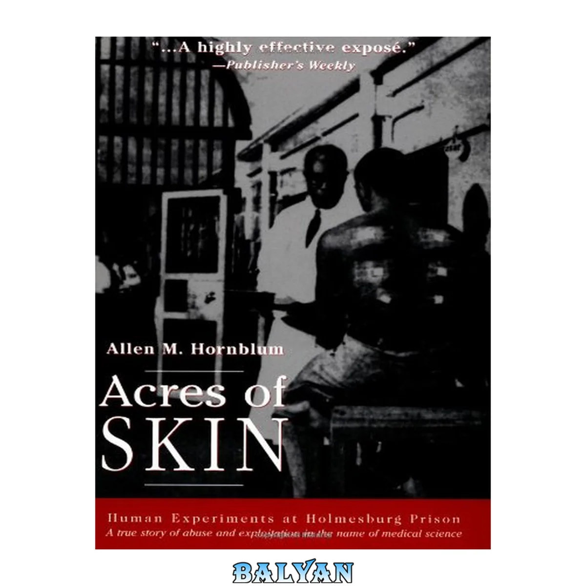 جلد کتاب Acres of skin : human experiments at Holmesburg Prison : a true story of abuse and exploitation in the name of medical science