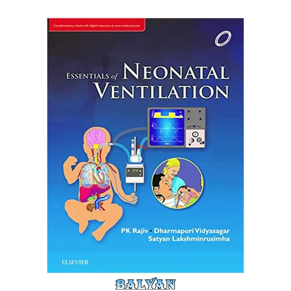Essentials of Neonatal Ventilation, 1st edition