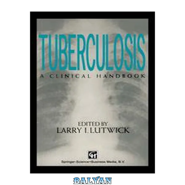 Tuberculosis: [a clinical handbook]